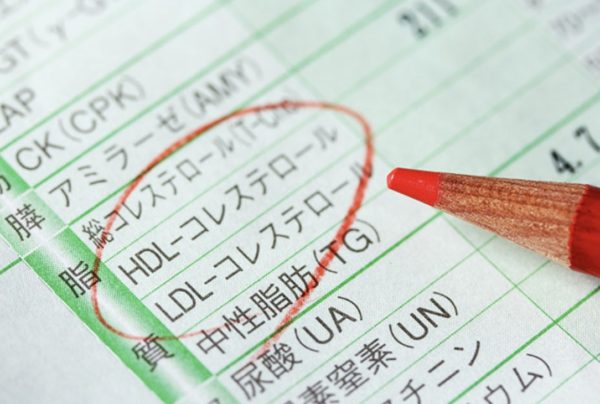 血液検査の結果でよくない結果が出ている写真