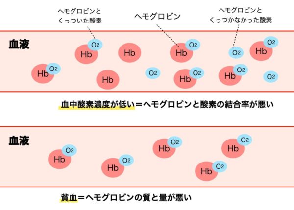 血中酸素濃度と貧血のちがいについてあらわした画像